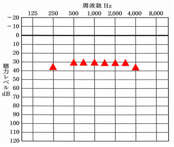 軽度の難聴(平均45dBほど)の場合における目標値。だいたいここまで補聴器で改善はできる。実際には、25dBでも大丈夫な方はいるが、割合としては少ないため、こちらをベースに考えると良いだろう。