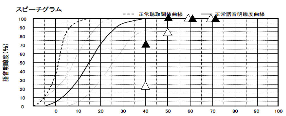 補聴器には、補聴器を装用した状態で、どのくらい音声が理解できるのか。という測定も行える。その結果は、こちらの通り、▲が補聴器あり、△が補聴器なし。補聴器なしでもそれなりに良い状態だった為、補聴器を装用し、さらに聞きやすくなるようにした。概ね、良い状態になる。