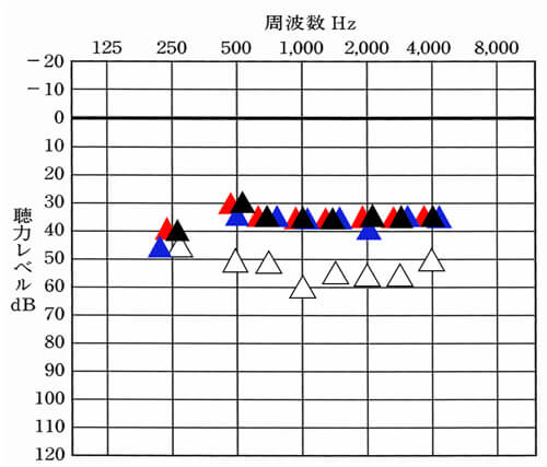 耳あな形にして、一気に改善。左右のバランスについても確認したが、それなりに良い状態だった。完全にぴったし合わせる事は、かなり難しいので、数値が大きく離れていないこと、体感的に、左右の違いをあまり感じないこと。この2つを満たせば、概ねOK。
