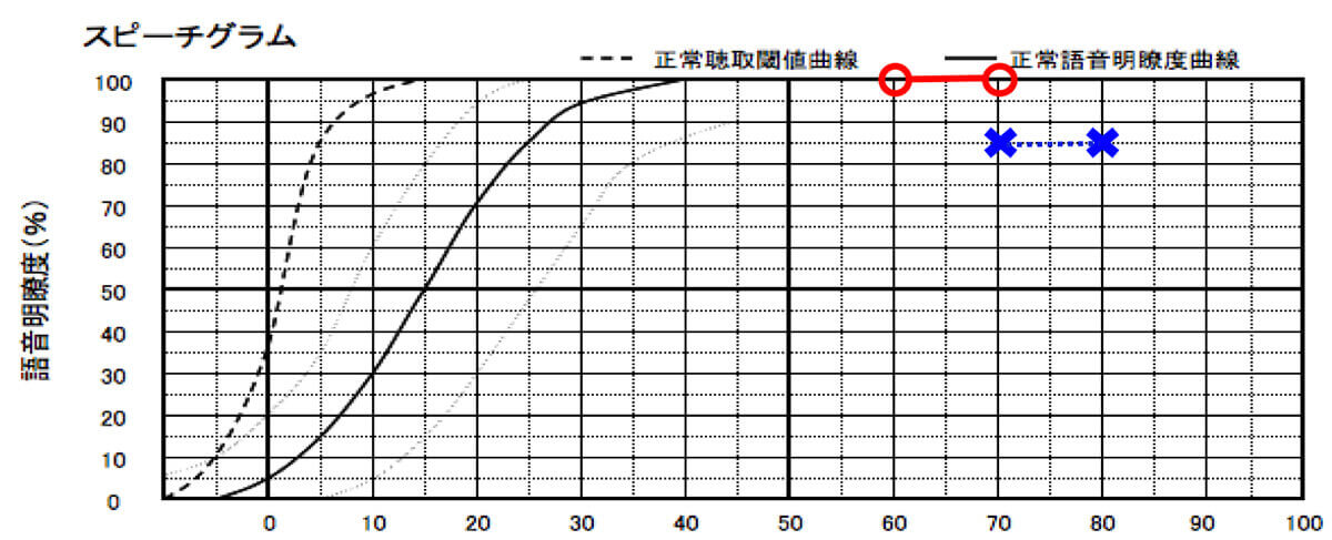 こちらは、補聴器の効果を見るための測定、語音明瞭度測定の数値。音をいれても音声の理解に繋がらない場合があるため、このような測定がある。