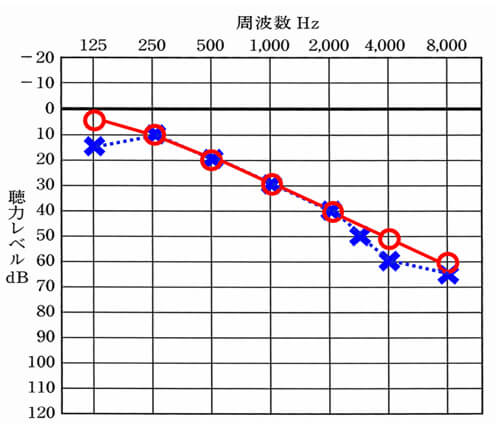 聴力に関しては、高い音が低下しており、音声がはっきり聞こえにくくなる傾向がある聴力になる。