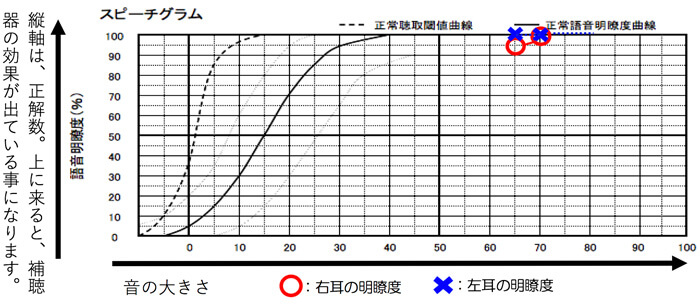 聞こえる音量から計り、調べた結果は、このような状態でした。