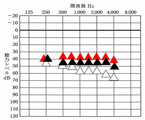 調整テクその①。改善目標から全部を一段階、もしくは、一番高い音だけ、2段下げ、まさに全体的に徐々に調整し、最終的に改善目標値まで目指すというやり方。この状態に慣れた後、全体的にあげても良いし、Volで2段くらいあげるとそのくらいの音量になるので、試験的にあげたりしながら、合わせていくと実は合わせやすかったりする。要はやり方次第である。