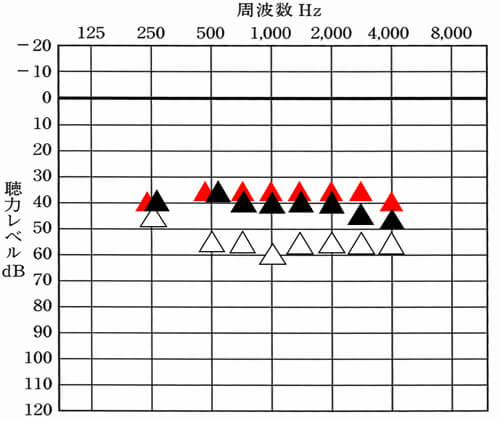 赤い▲補聴器で改善を目指す部分。黒い▲は、補聴器で今現在、聞こえている部分。△は、補聴器なし。赤と黒を比較すると、今現在、どのくらい聞こえているのかを把握する事ができる。体感的にもう少し大きくしても良さそうなら、目標まで改善できると、より聞こえが改善できる。