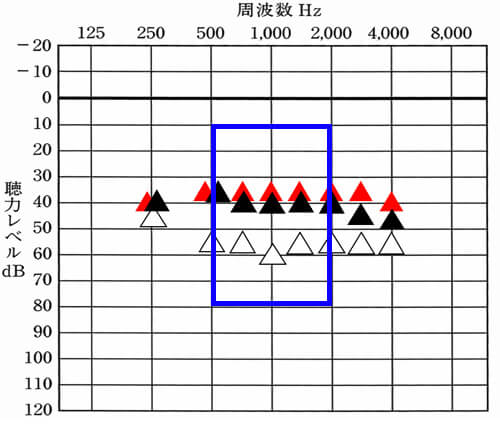 個人的に調整をしていて感じることは、500Hz〜2000Hzあたりを改善させると、音声の聞きやすさは上がる傾向がある。上げるのが厳しい場合は、これらの部分だけでも優先して改善してみよう。すると、できる限りの改善は、しやすくなるはずだ。