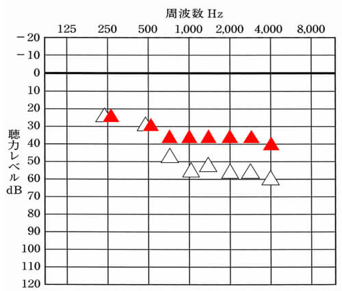 仮に聞こえている部分があれば、その部分は、聞こえているままにし、下がっている部分だけを補えば良い。比較対象となるものを作るのは、物事を判断する上では、非常に重要な内容になる。