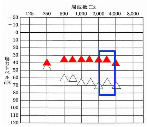 アラーム系は、この辺りが関係しやすい。実際には、様々な音があるので、1000〜4000Hzまでを満遍なく改善してあげると良かったりはする。