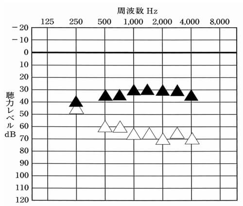 体感だけでは、どのくらい聞こえているのかわからないため測定。特に低い音がどれだけとか、高い音がどれだけ聞こえているのかは、流石に測定しないと把握できない。