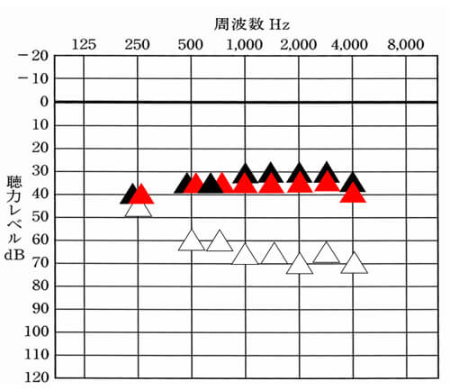 測定結果としては、良好。測定結果と改善目標値の2つを比較できれば、どの部分が足りていて、どの部分が足りていないのかがわかるようになる。このようにして、改善したら良い数値まで改善していけると、聞きにくさは、改善しやすい。