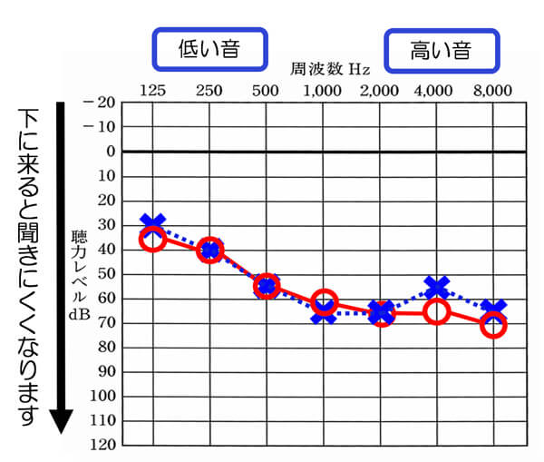 難聴は、一律に下がるわけでもないし、かつ、人によって聞きにくくなるレベルから、聴力の傾向まで異なる。一通り補えるようにするために、周波数別に補えるようにし、なるべく多くの人を補えるようにするためにこのようにしている。