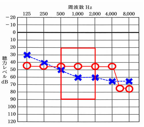 音声の部分は、500〜2000Hzあたりが影響しやすい。この部分が下がると下がるほど、音声の聞きにくさが強くなる。