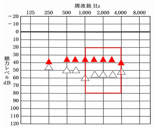 そして、アラームや他の音も気がつくよう、この部分も補ってあげることが重要。アラームや高い音が気がつくようになれば、様々な合図がわかるようになり、生活も職場での対応もしやすくなる。
