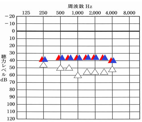 聴力が左右で異なる場合は、なるべく左右のバランスを合わせてあげることも大切。この場合、無理をするのはよくないが、合わせられるのであれば、左右のバランスは、よくしてあげられるとよりよくすることができる。