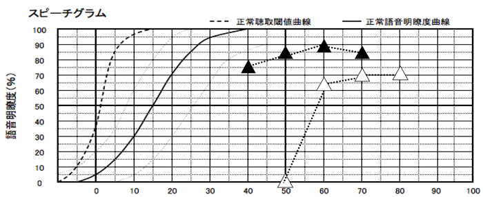 語音明瞭度測定の補聴器版の結果。この段階で、結構な改善値ですが、まだ改善を伸ばせそうでしたので、さらに少し伸ばしていくことになります。