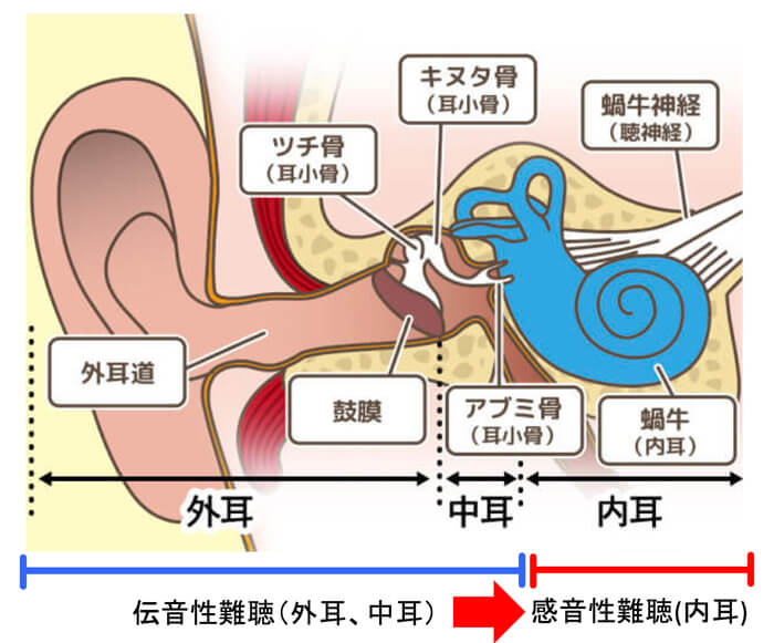 補聴器を装用する方は、大半が感音性難聴という難聴。感音性難聴は、耳の中の内耳と呼ばれる部分の損傷により、引き起こされ、それにより、音が聞きにくい他、音声が理解しづらいという症状も出てくる。それが特徴。