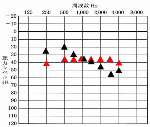 こちらでは、現在の聞こえ。右側のみの聞こえを▲。目標値を▲としています。