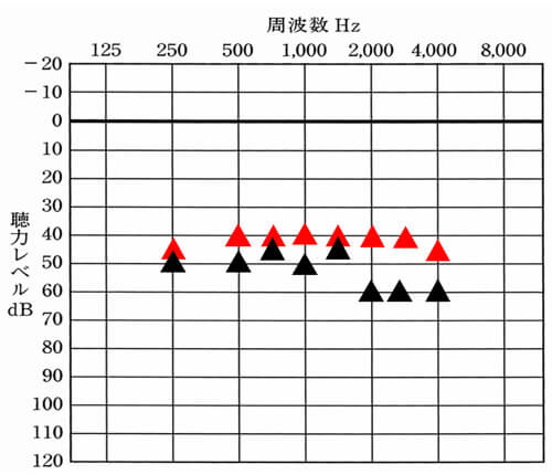 こちらは、左側のみの聞こえを▲。改善目標値を▲としています。