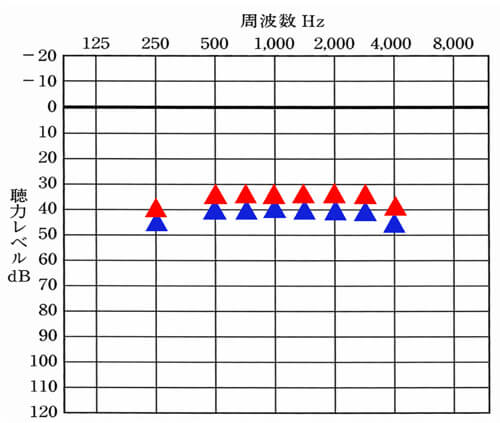 ▲が右側の聞こえの目標値、▲が左側の聞こえの目標値です。