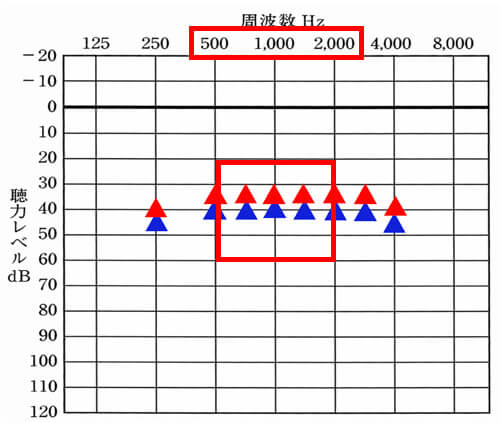 音声の部分で影響するのは、500〜2000Hzが多いため、この部分は、なるべく達成したいところです。だからと言い、無理に改善させることは、するべきではありません。