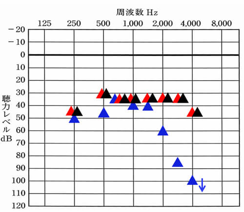 右側は、初回からそれなりに改善できたのですが、左側は高域になると改善が急にできなく。この事態受け、次回からは、もう少し改善していけるように修正していくことにしました。