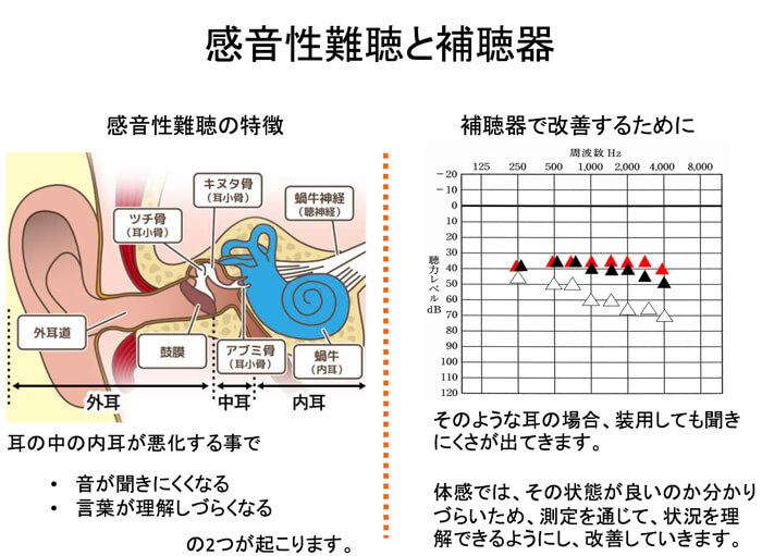 感音性難聴の場合、補聴器を装用しても残念ながら耳が治る。というところまでは、いきません。どこかしら、聞きにくさを感じる事があるため「聞こえるけれども、これで本当にいいのかな?」という疑問を持ちがちです。体感だけではなく、測定を通じて、現状を理解できると、今現在の状態の良し悪しを把握しやすくなります。