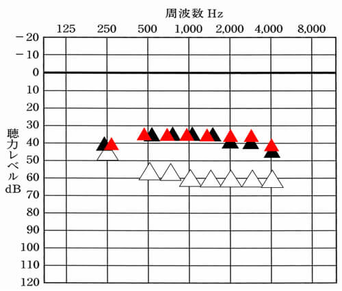 音の体感に関して確認した後、仮に大きくしても良さそうなら、大きくして、なるべく改善目標値まで目指していきます。