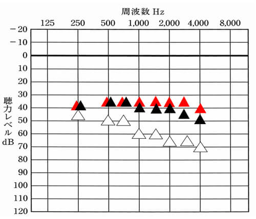 ▲が補聴器を使用した時の聞こえ、▲が補聴器を使った時にここまで聞こえていると良い数値。目標と現状が比較できると、今どのくらい改善しているのか。そして、もう少し改善させるとしたら、どこを改善させるのか。という部分がわかるようになります。これが客観評価の良いところです。