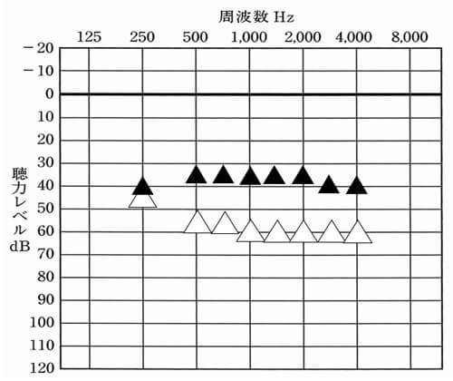 実際に改善してみた結果。このようになりました。