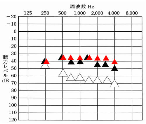 少し前の繰り返しですが、目標となる改善値がわかると、現状の数値を比較する事で、どの部分が足りていて、どの部分が足りていないのか。というのがわかりやすくなります。そして、ここに音の体感を入れる事で、もう少し改善しても良さそうなのか。それとも、このくらいまでにしておくのか。なども相談しやすくなります。