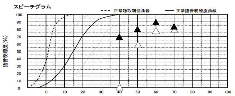 こちらの場合、補聴器なしの状態で、80%が最良の結果になっています。そのため、50dB、60dB、70dBで、70〜80%、もしくは、それ以上のパーセンテージになっていれば、良い状態です。なお、この基準は、かなり高い方ですので、実際には、ここまでよくならない方もいます。