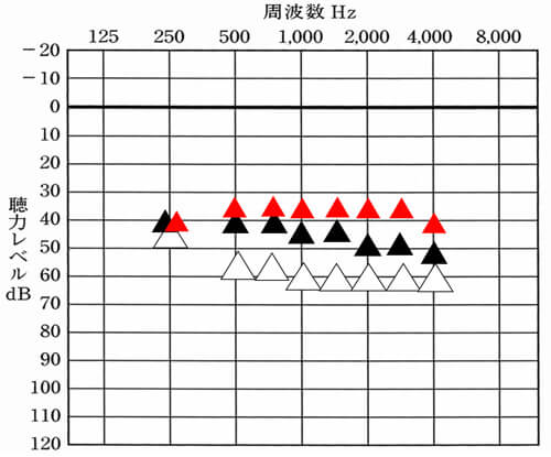 次は、調べてみた結果、現状の改善値が少し足りないケースです。この場合は、音の体感により、対処が大きく変わります。