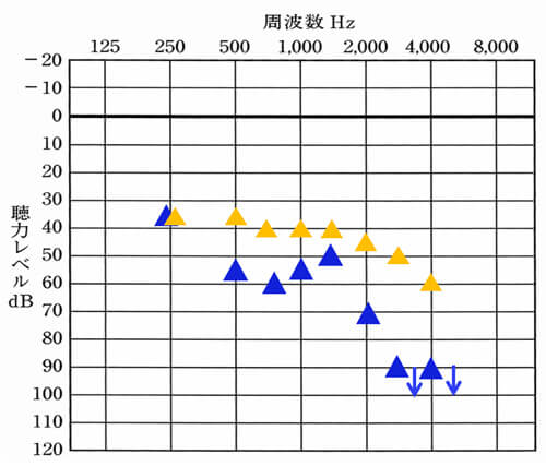 こちらは、左側のみの状態。▲の位置が左側における改善目標値です。〜2000Hzあたりまでは、40〜45dBくらいが目安になります。