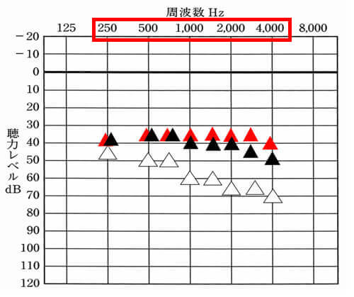 今現在調べられる周波数は、250Hz、500Hz、750Hz、1000Hz、1500Hz、2000Hz、3000Hz、4000Hzの計、8つ。そのため、12chあれば、それぞれの部分をよくしやすい。