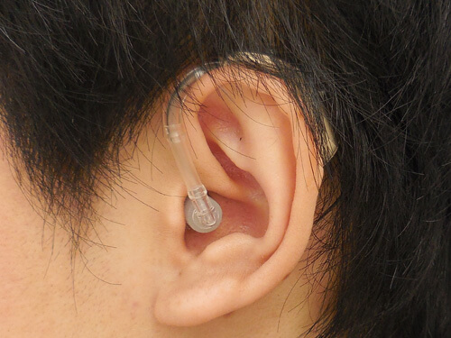 よく考えるのは、聞こえなくなった耳側に補聴器をつける事です。しかし、一部の耳の状態の方は、この方法では、ほとんど改善できない事があります。