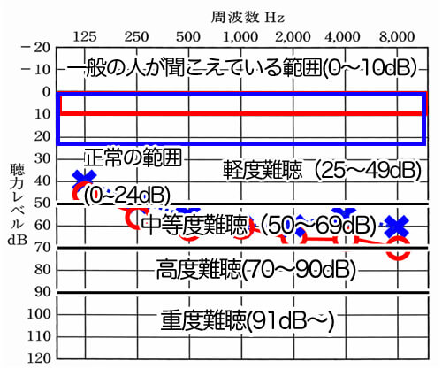 それぞれの聴力別、状態になります。基本的には、500Hz、1000Hz、2000Hzを足して計算する4分法と呼ばれる方法で、平均聴力を出して行きます。