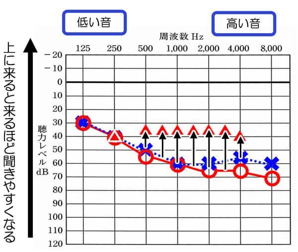 補聴器には、聴力ごとに補えると良い数値があらかた決まっています。その部分まで改善させられると、聞きにくさの改善がしやすくなります。