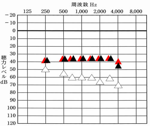 測定結果を比較してみると、ぴったり。こちらは、例ですが、意外にもこのようになるケースは、あります。