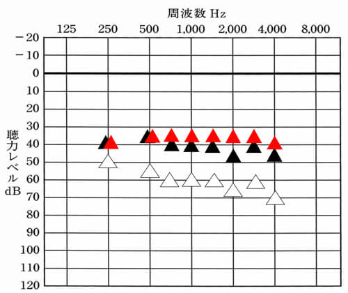 目標値と現在値を比べてみると、現在値は、少し低いことがわかります。このような場合は、補聴器を使用している感覚で今後の対応が変化します。あげても大丈夫そうなら、補強しますし、あげるのが無理そうなら、ひとまず、このままか、少し下げたりすることもあります。