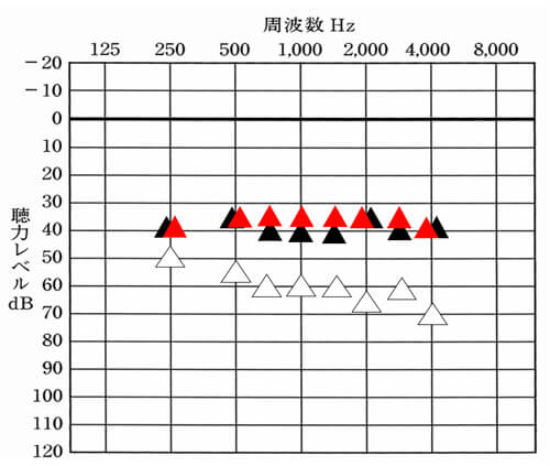 比較すると少し足りない部分があるのがわかります。