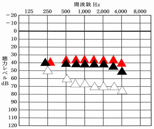 それらを見つつ、調整し、聞こえを改善できるところまで入れていきます。もちろん、無理に入れて使うのではなく、場合によっては、徐々に改善をしていきます。
