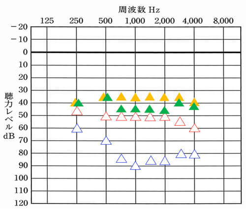 聴力からのおおよその改善目標値。<span style="color: #ffcc00;">▲</span>が右側、<span style="color: #339966;">▲</span>が左側の改善目標値です。聴力は、下がると下がるほど、補いにくくなるため、改善目標値が異なります。