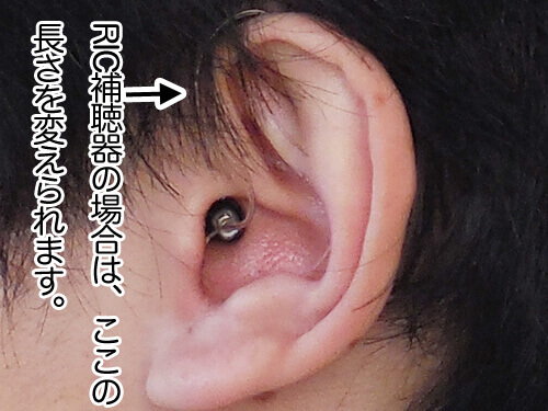 RIC補聴器の場合、耳の穴から補聴器本体までの長さを変えられるようになっています。この部分が長すぎたりしなければ、しっかり装用できるようになります。