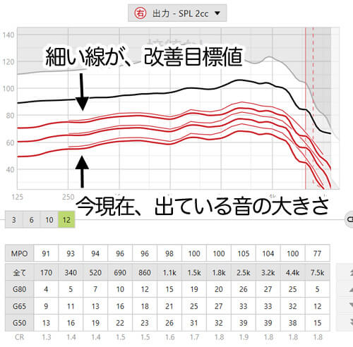 補聴器の調整画面です。補聴器の調整画面では、今現在、出ている音の強さと、改善できると良い改善目標値が出ていたりします。