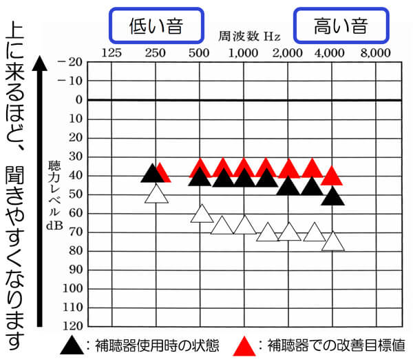 補聴器は、ご自身の聴力を補えると良い部分まで改善させる事ができると、聞きにくさを改善しやすくなります。その機能は、どの補聴器にも搭載されています。