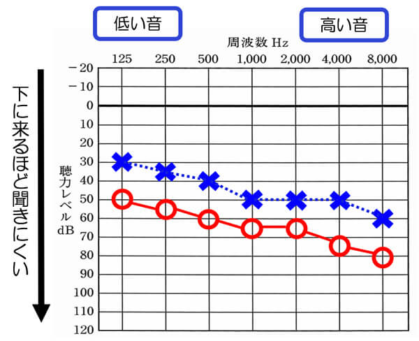 左右の聴力が少し異なるケース。このような場合、聞こえにくい耳側が、音の感覚が異なるケースが、多々あります。