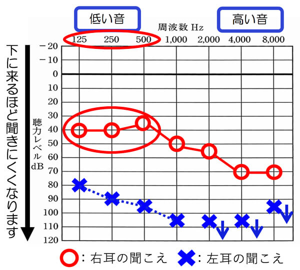 基本的に、低域である125〜500Hzあたりまでが60dBより、軽い場合(小さい数値だった場合)、耳あな形補聴器をつけると、自分の声がこもったり、内側で響いたりしやすくなります。