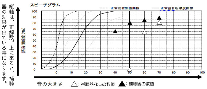 補聴器の世界には、言葉の聞こえを調べるものもあります。語音明瞭度測定、語音弁別脳検査。という言い方をします。