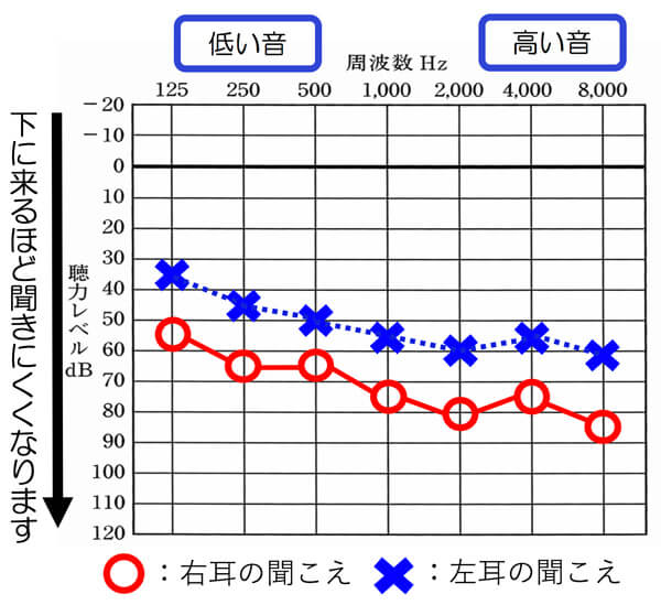 左右の聴力が異なる場合も、左右の耳の状況を把握しつつ、改善を行なっております。