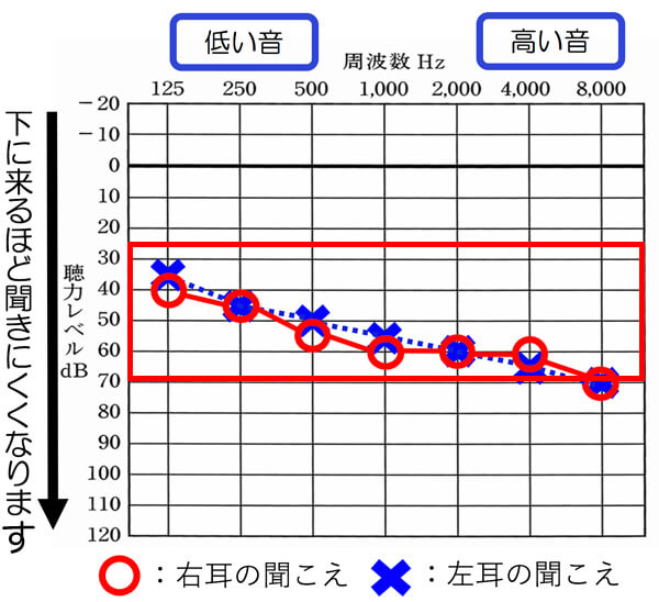 赤い枠の中が、軽度・中等度難聴になります。この範囲内に概ね入っていれば、対象となります。