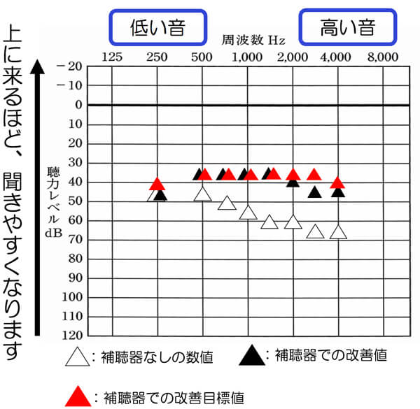 補聴器の状態は、補聴器でどのくらい改善できると良いか、そして、今現在、聞こえている状態は、どんな状況なのか。これらを把握できると、非常にわかりやすくなります。お互いに状況を把握しながら、どう改善していくかも、当店では、ご相談しています。